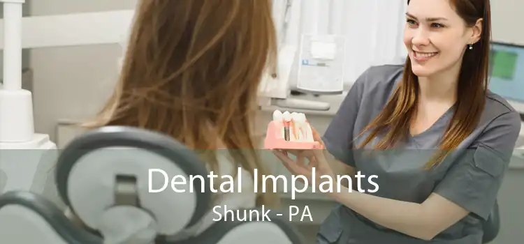 Dental Implants Shunk - PA